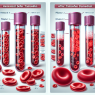 Hematocrit and red blood cell changes from tamoxifene